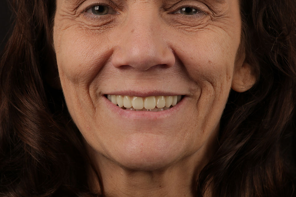 happy smiling patient 